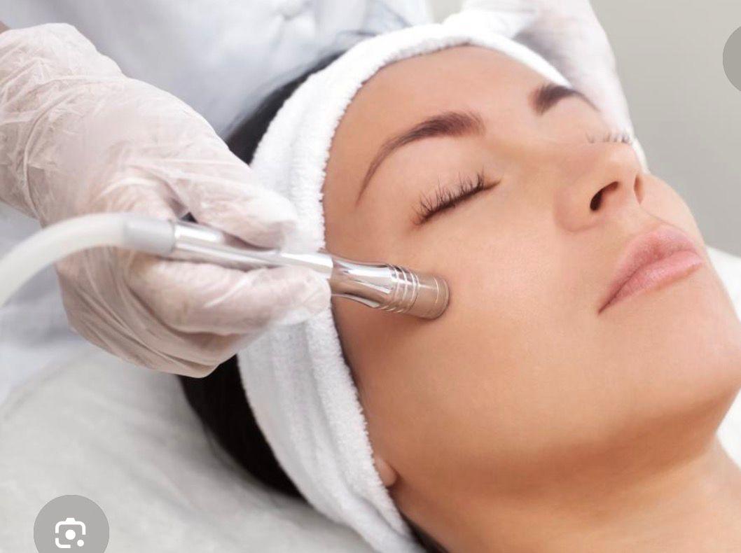 Microdermabrasion