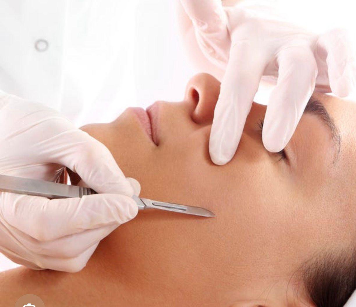 Dermaplaning